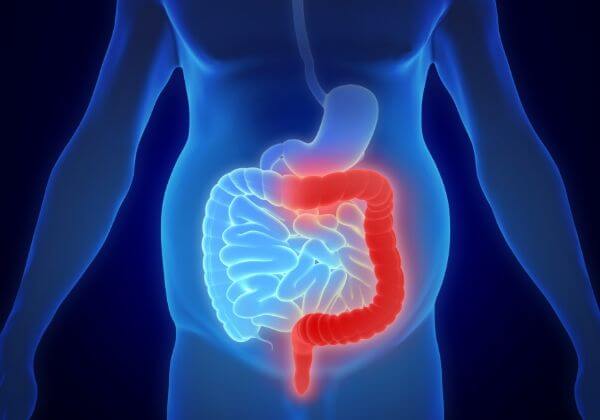 Inflammatory Bowel Disease - Digestive Disease - 1MD