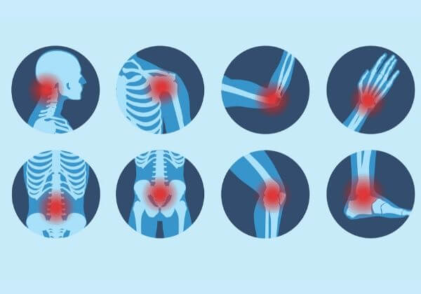 Chronic Inflammation of the Intestinal Tract