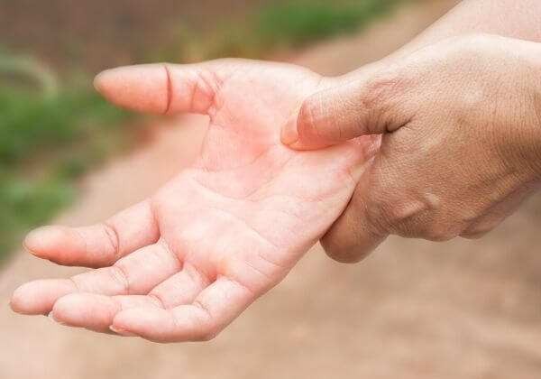 What Is Carpal Tunnel Syndrome?