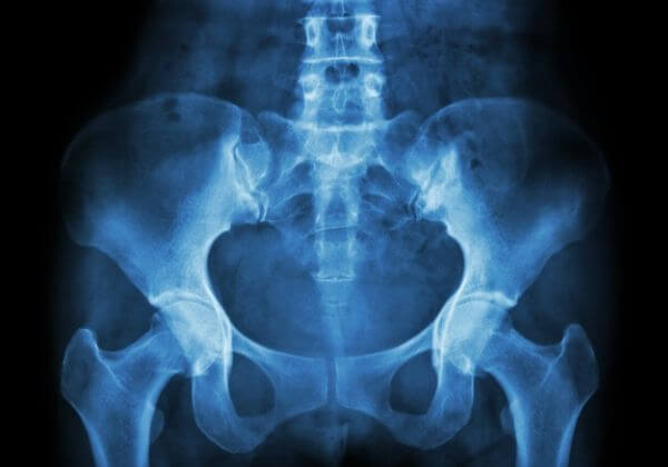 Pelvic Pain Symptoms- Joint Symptom - 1MD