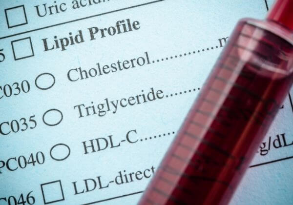 High Cholesterol: Symptoms, Causes, and Diet as Treatment