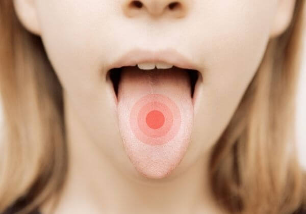 The Tongue Color Code: What Your Tongue Color and Appearance Indicates