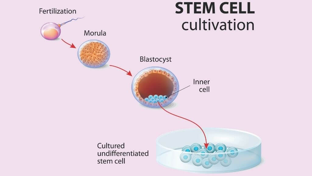 5-stem-cell-therapy-benefits-for-heart-disease-joint-pain-more