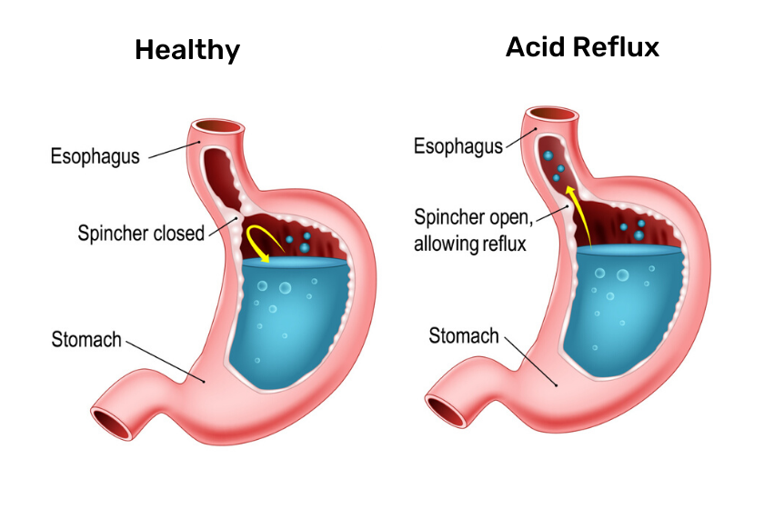 2021's Most Effective Digestive Enzymes on the Market Smarter Reviews