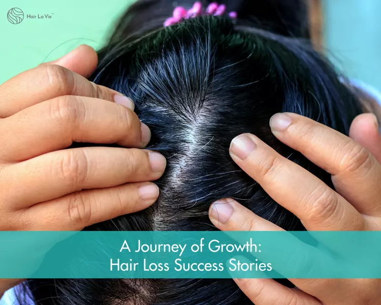 How I Grew My Hair Back: Women's Hair Loss & Regrowth Success Stories