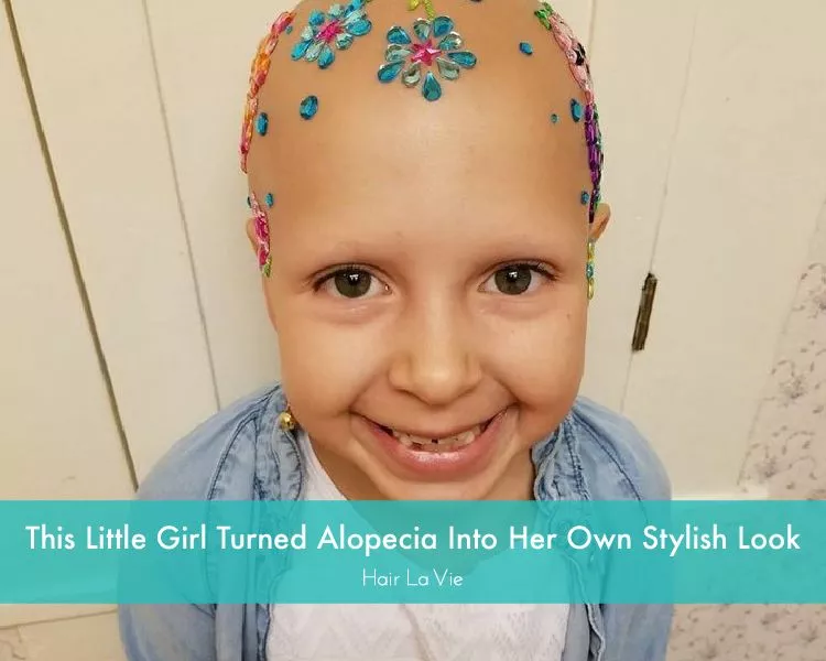 Adorable Girl With Alopecia Rocks Her Hairless Style At School