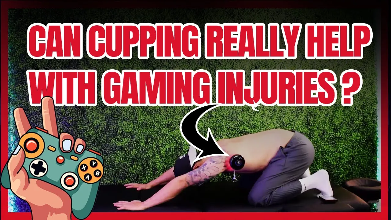 Can Cupping really help with gaming injuries?
