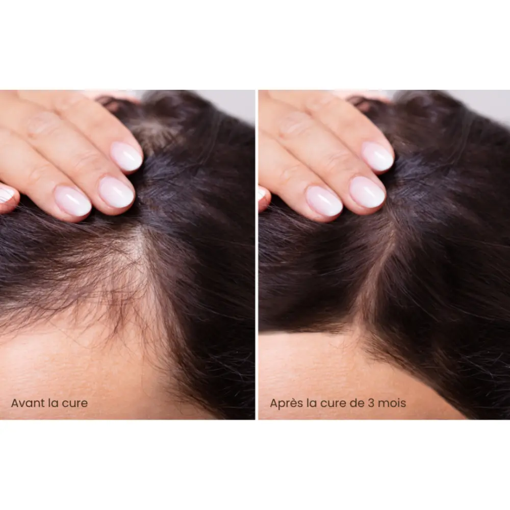 HairBoost+ — reBloom