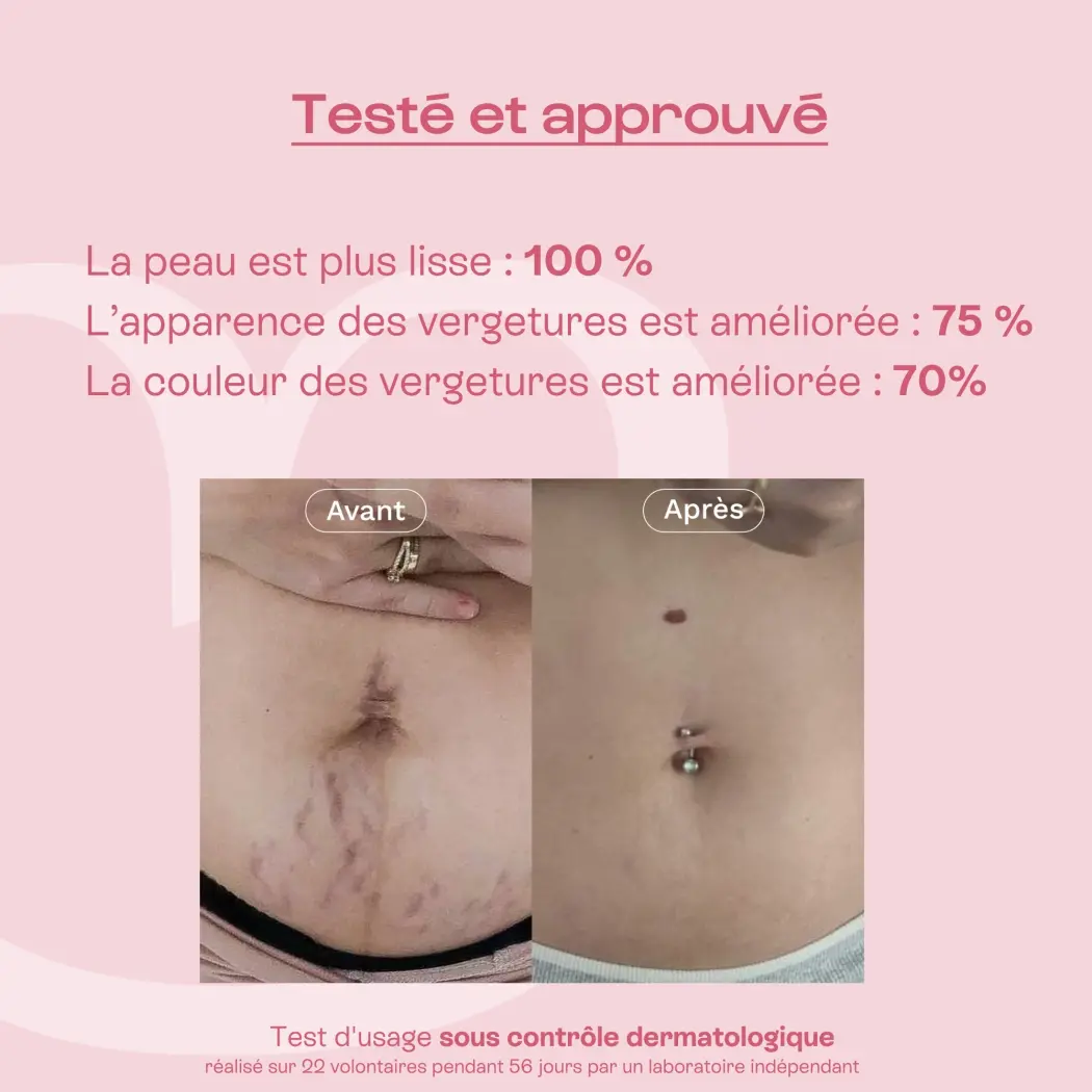 L'Expert - Crème Anti-vergetures — Omum