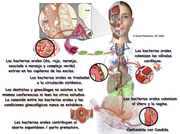 El Vínculo Entre Los Microbios Orales y Los Problemas de Salud Sistémicos - Image 4