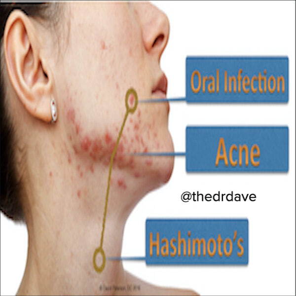 The Link Between Oral Microbes and Systemic Health Issues. Function Health Guide to Periodontal Bacteria. - Image 4