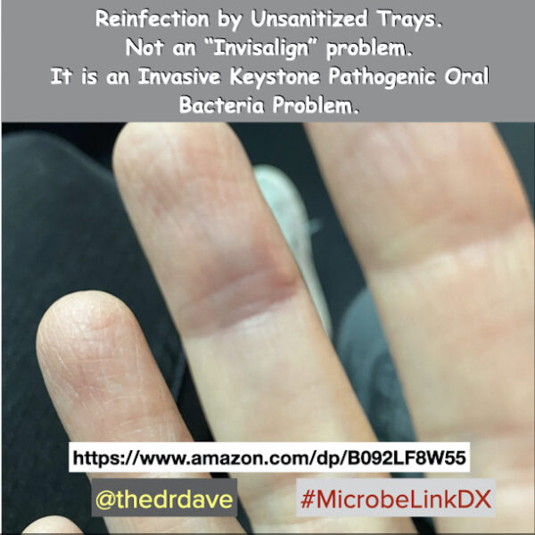 MicrobeLinkDX Oral DNA/PCR Bacterial Infection Test Kit - Image 3