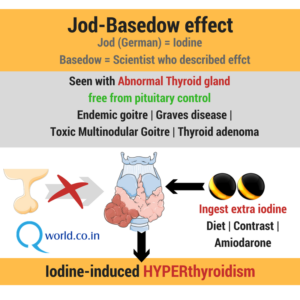 Jod-Basedow Phenomenon Iodine-Induced Hyperthyroidism