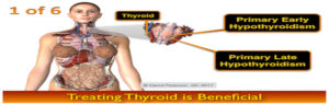 Early or Subclinical Hypothyroidism