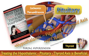 Hypothyroidism - Secondary to Hypothalamic-Pituitary-Thyroid (HPT) Axis Dysfunction