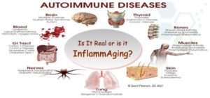 Autoimmune: Understanding the Uncontrolled Immune Response