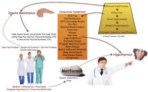 Diagnosing Hypothyroid vs. Insulin Resistance. The Path of Least Resistance