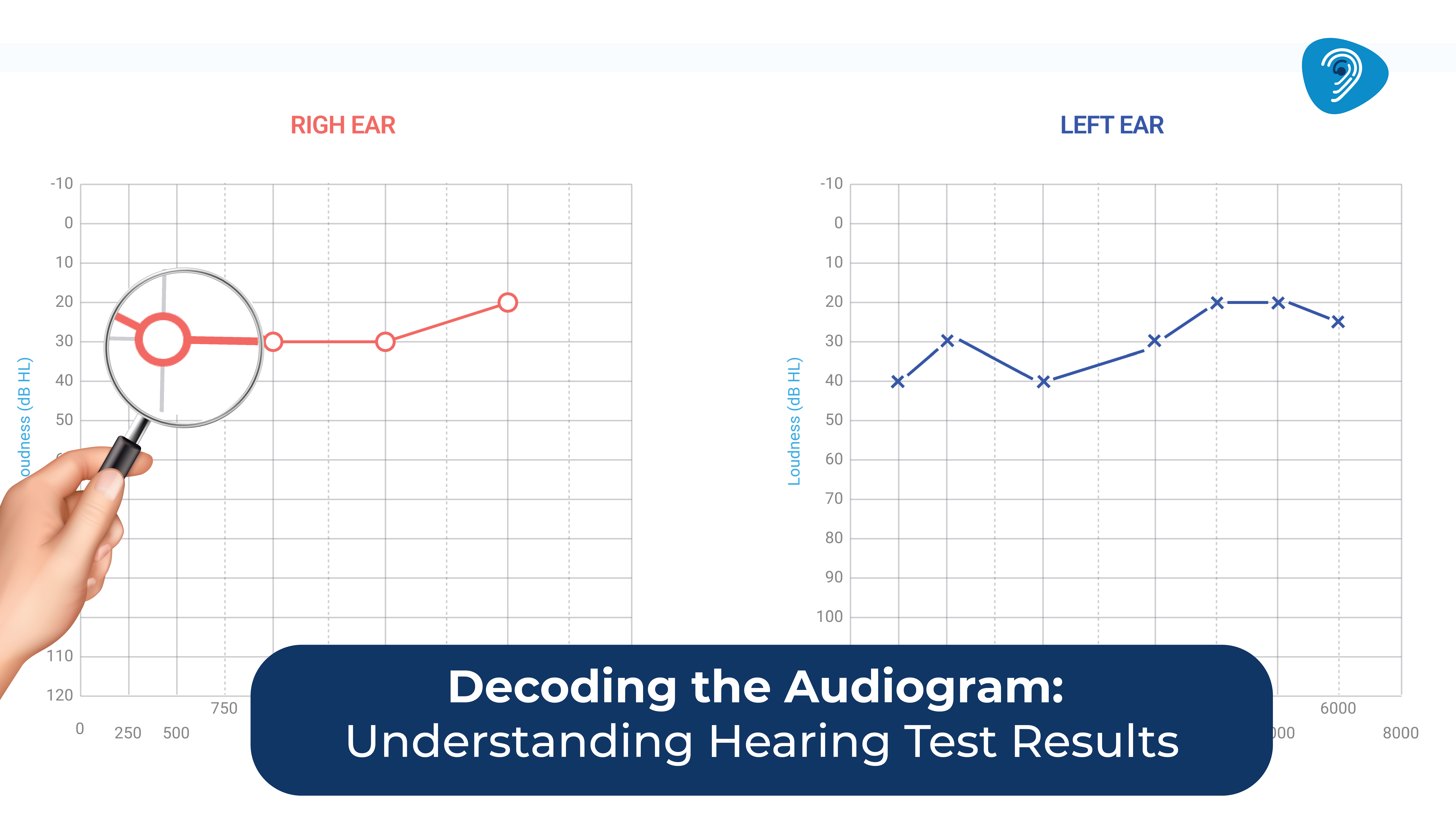 Decoding the Audiogram: Understanding Hearing Test Results