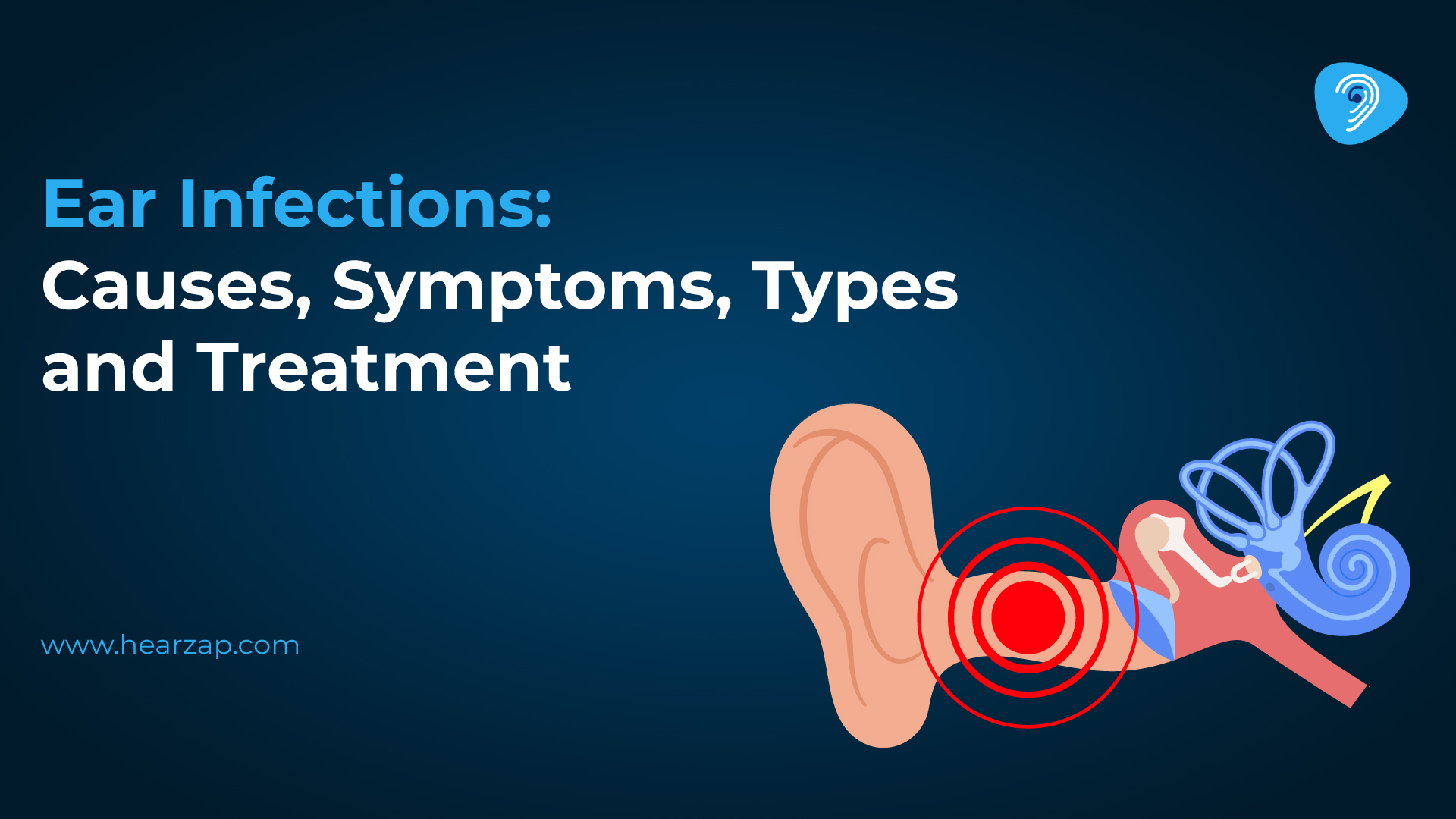 Ear Infections: Causes, Symptoms & Treatment