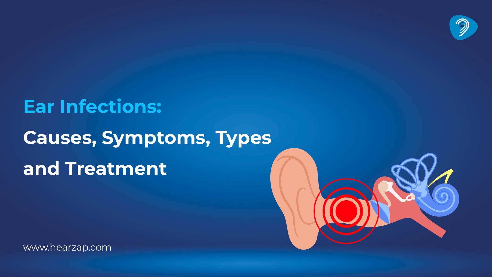 Ear Infections: Causes, Symptoms & Treatment