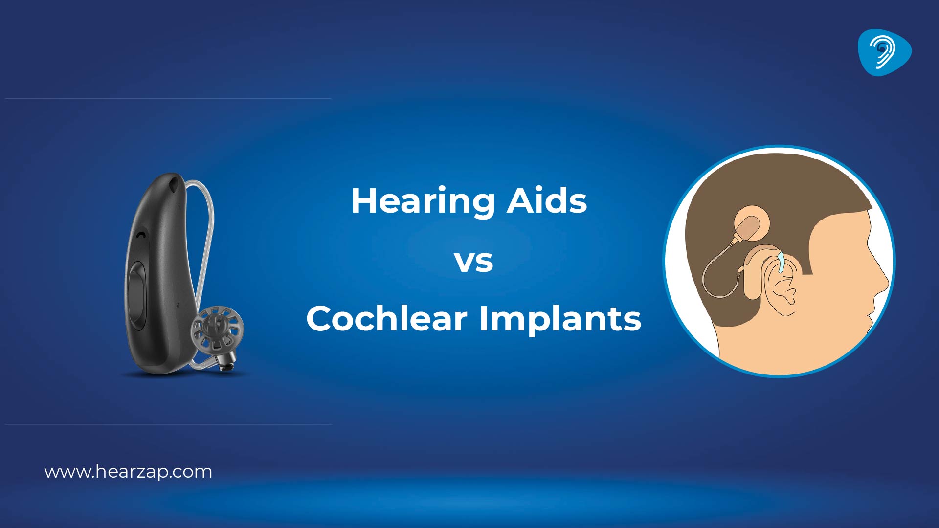Hearing Aids vs Cochlear Implant