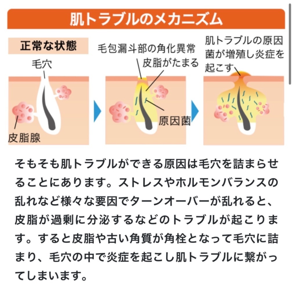 【薬用いつかの石けん】ニキビを防ぐ酵素洗顔石けん(医薬部外品)｜泡パック・背中・体臭ケアにも
