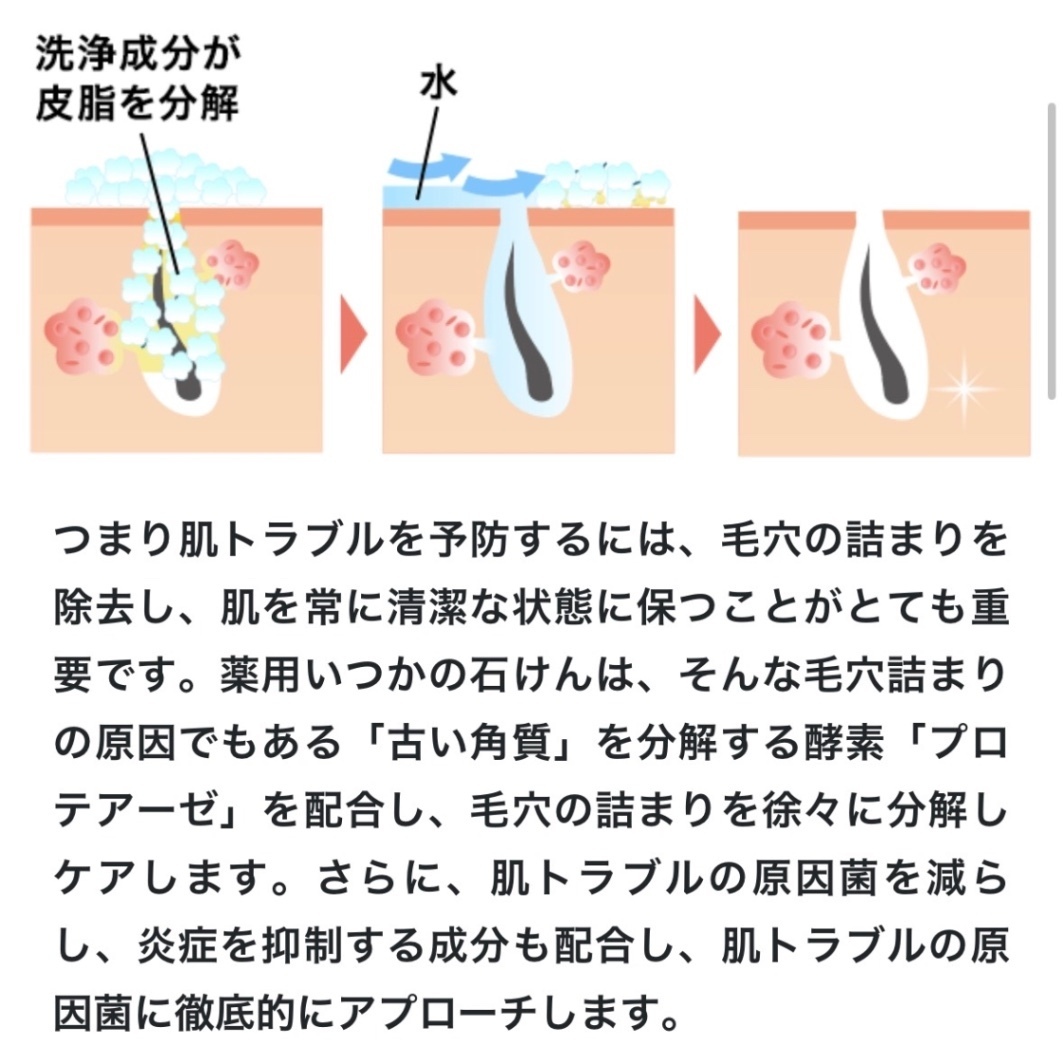 【薬用いつかの石けん】ニキビを防ぐ酵素洗顔石けん(医薬部外品)｜泡パック・背中・体臭ケアにも