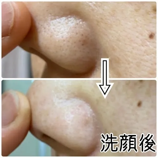 【稼げや祭り 送料半額＋特典🎁】【いつかの石けん】酵素洗顔石けん |毛穴の角栓・黒ずみ・足のニオイに