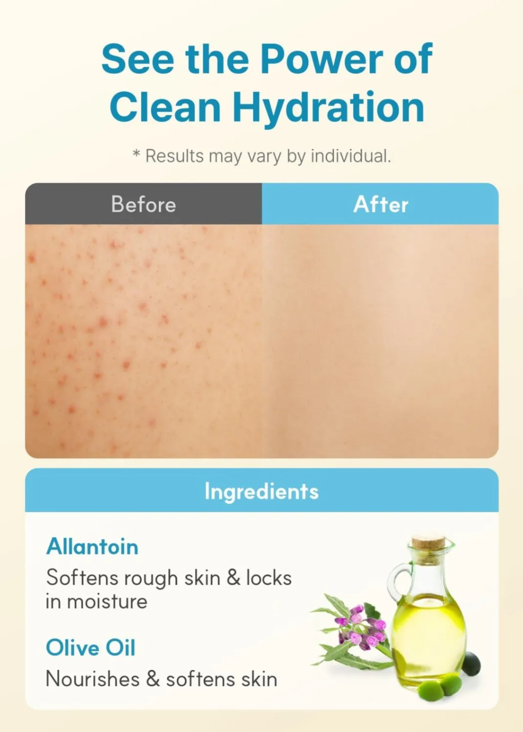 Derma:B(ダーマビー) デイリーモイスチャーボディローション 400ｍL