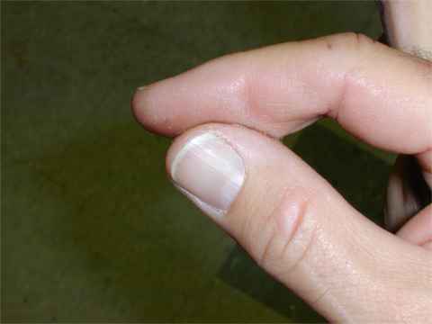 superglued fingers how to free them fast with this clever household hack