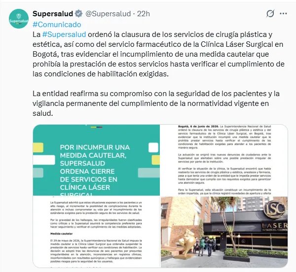 Imagen pegada