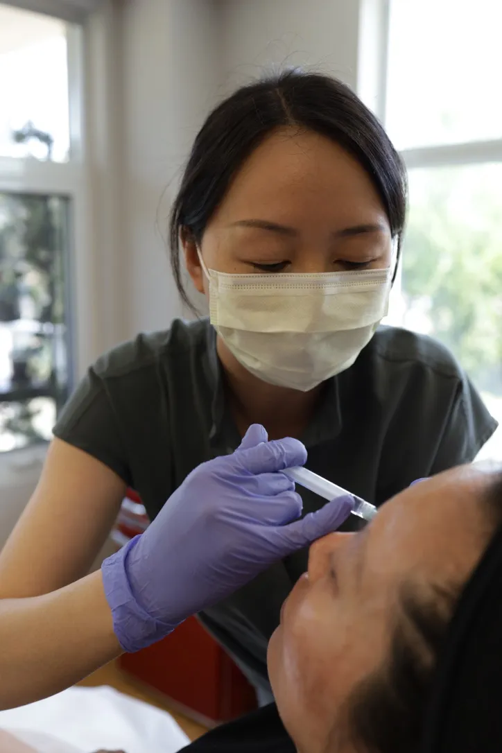 Sculptra facial rejuvenation procedures by Skin Trek, Toronto, we care like it's self care
