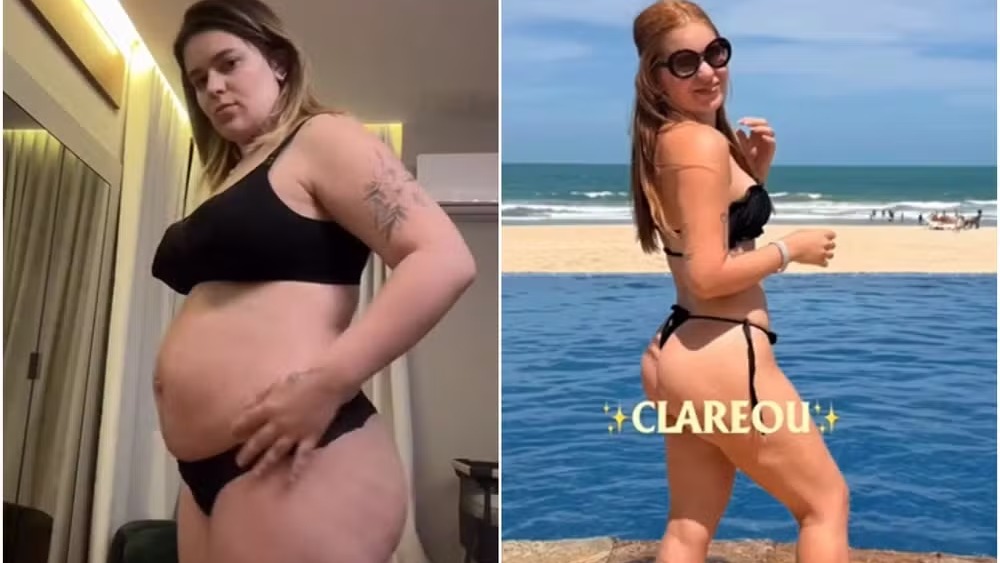 Viih Tube mostra a transformação de seu corpo com a perda de 32 quilos, resultado de novos hábitos e procedimentos cirúrgicos. Viih Tube antes e depois da transformação corporal, de lingerie e biquíni com CLAREOU