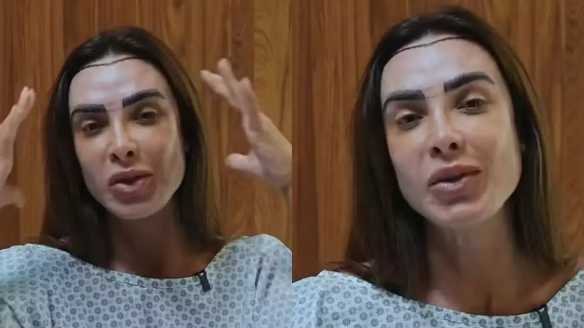 A busca por soluções para a saúde capilar, como o tratamento da alopecia, é um tema de crescente interesse. Mulher com cabelo castanho, marcas escuras no rosto, em bata hospitalar, gesticulando.