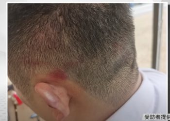 想出金就打？JPEX用戶「遭黑衣人圍毆」：1月起無法提款、叫我去香港面交