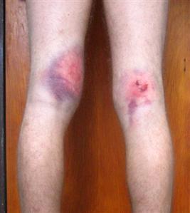 แบ่งกระสุนยาง กระสุนพริกไท สำหรับปืนสั้นทุกขนาด