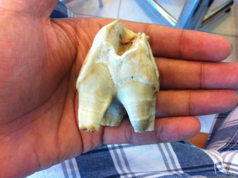 ฟันกรามสมเสร็จ