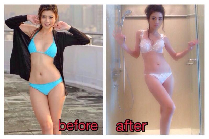 ไลโปทวิน lipo twin สาเหตุของต้นแขนใหญ่