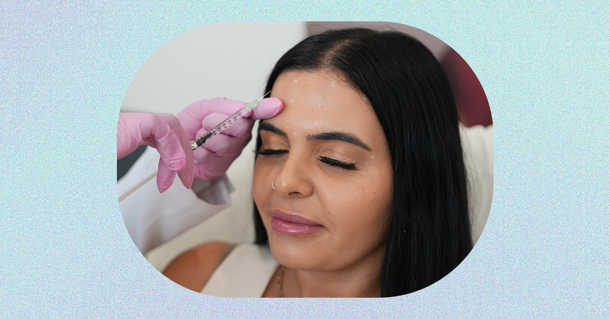 Laser away article image for Do Botox And Xeomin Actually Prevent Wrinkles?