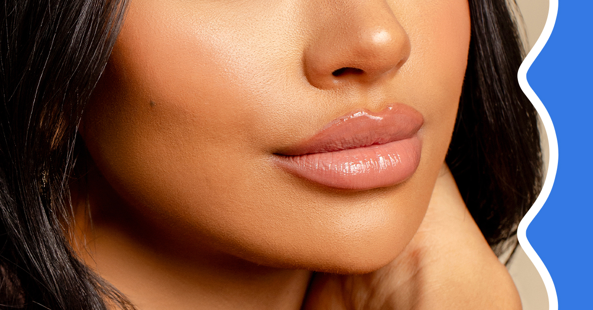 Laser away article image for Lip Augmentation 101: Your Guide to Lip Fillers