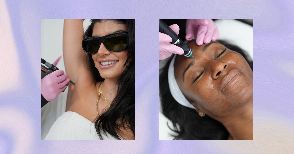 Laser away article image for The 8 Best Pre-Wedding Skin Treatments