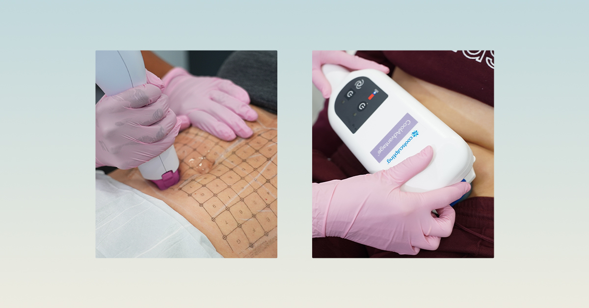 Laser away article image for What’s the Difference Between Thermage & CoolSculpting?