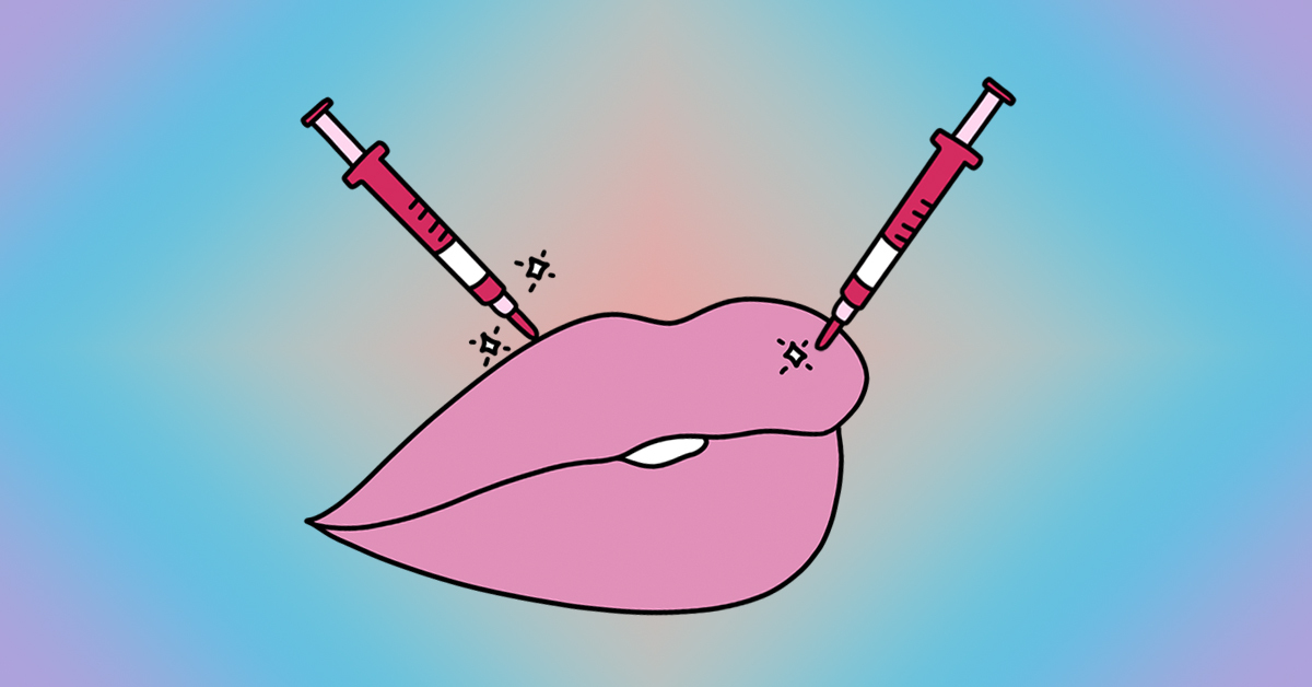 Laser away article image for All your Burning Questions About Lip Fillers Answered