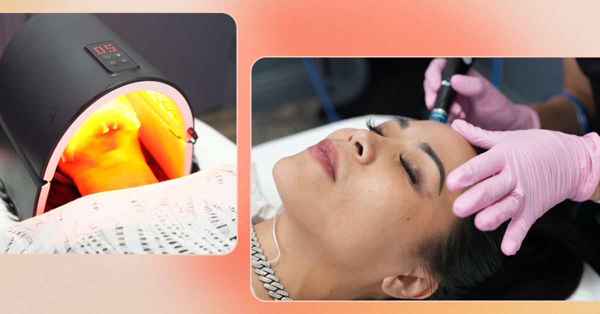 Laser away article image for Hydrafacial vs Chemical Peels: Which One Is Better?