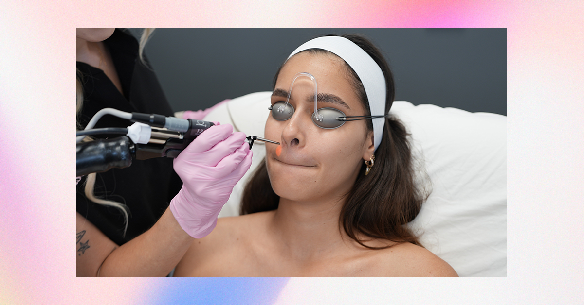 Laser away post image for What Types of Lasers Are Used For Laser Hair Removal?