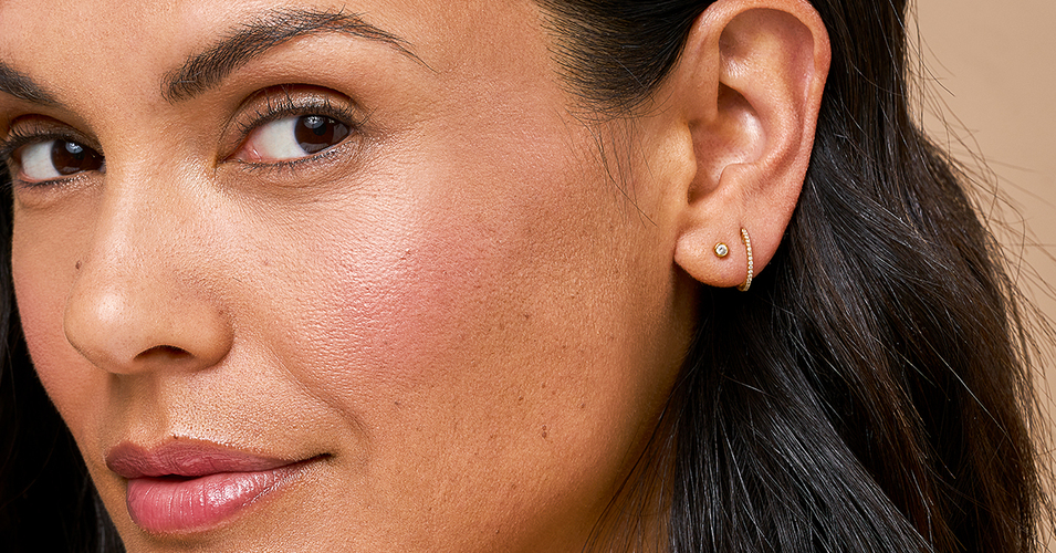 Laser away faq image for How Do I Get Rid Of Oily Skin?