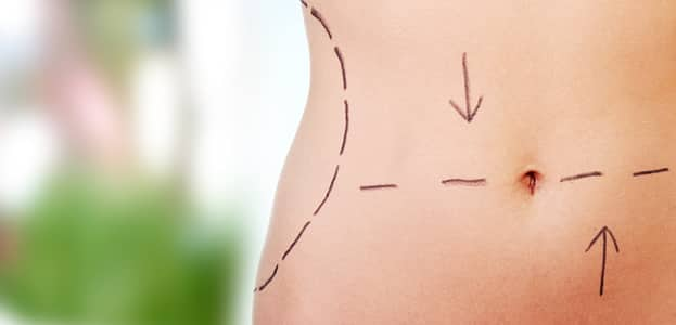 Best Body Contouring Procedures After Weight Loss