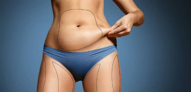 Laser away post image for Safe Alternative To Liposuction