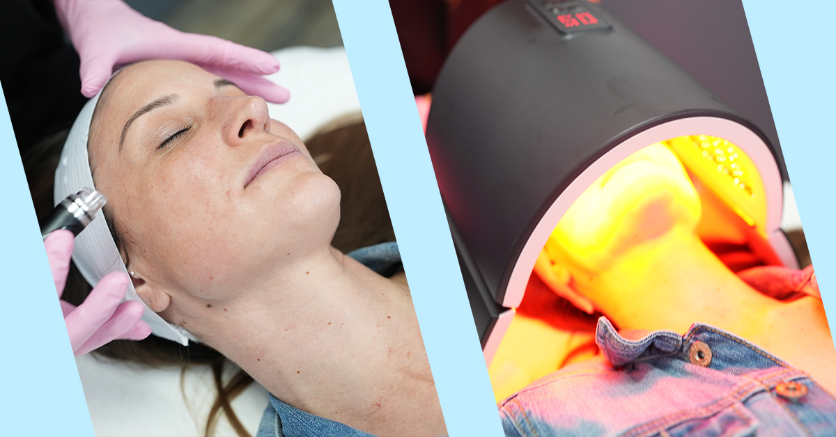 Laser away post image for Everything You Need to Know About Hydrafacials