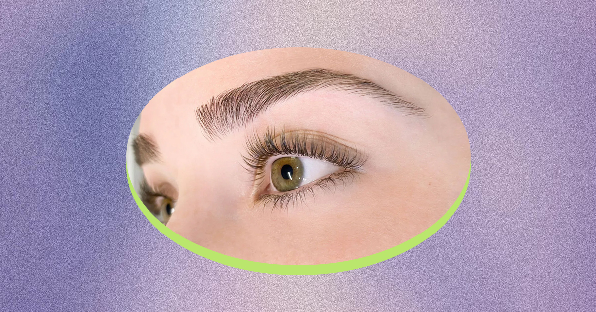 Laser away image for How Can I Permanently Remove Eyebrow Hair?